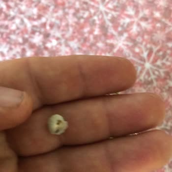 Penguen Konserve Bezelye İçinde Salyangoz Bulunması