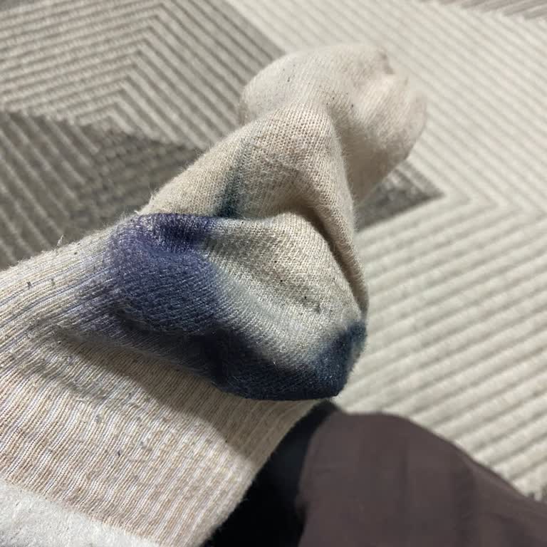 Üretim Hatası Ve Garanti Sürecinde Destek Eksikliği