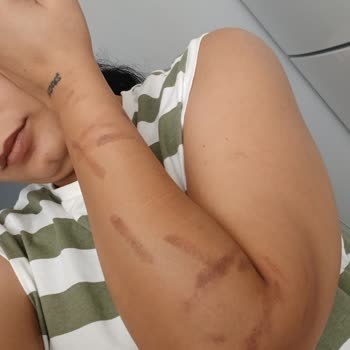 Mabel's Güzellik Salonu'nda Kollarımı Yaktılar