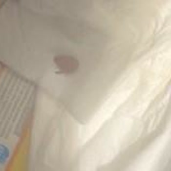 Glories Vişneli Bitter Çikolatasında Çekirdek Sorunu Ve Diş Kırılma Riski