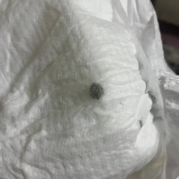 Molfix Bebek Bezinde Siyah Leke Ve Toz Birikintisi: Sağlık Endişesi