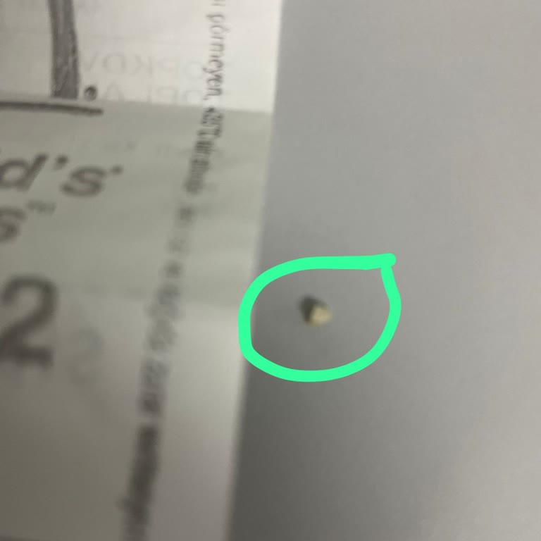 McDonalds Rams Garden Şubesinde Quarter Pounder Menüsünde Yabancı Madde Ve Diş Hasarı