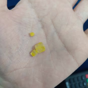 A101 Sürpriz Yumurtasında Cam Parçaları: Çocuk Güvenliği İçin Acil İnceleme Talebi