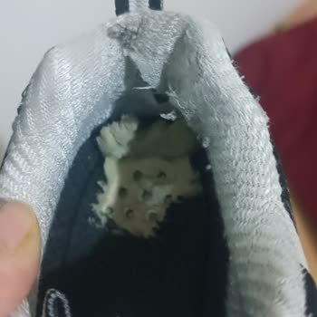 Kısa Sürede Yırtılan Skechers Ayakkabısının Kullanıcı Hatası Olarak Değerlendirilmesine İtiraz