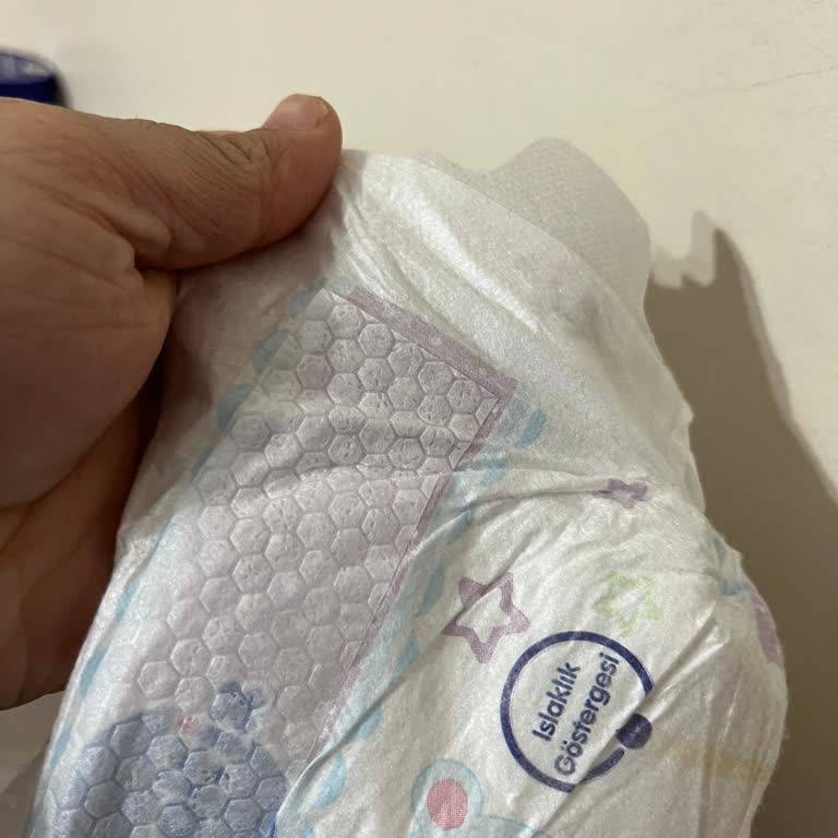 Molfix Bebek Bezi Cırt Cırt Sorunu İdrar Kaçırma Ve Ücret İadesi Talebi