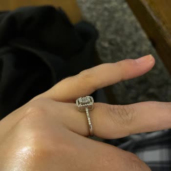 Tekrarlayan Taş Kararması Nedeniyle Yüzük Değişimi Talebi