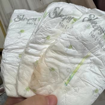 Sleepy Bebek Bezinde Taşlaşma Ve Sert Parçalar