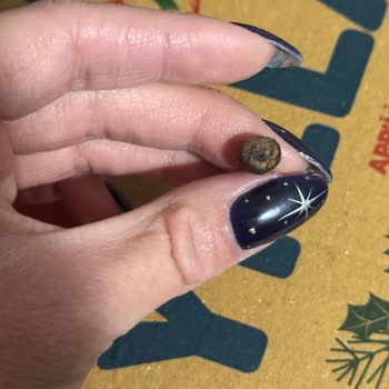 Domino's Pizza Zeytin Çekirdeği Nedeniyle Diş Kırıldı, Masrafların Telafisi Talebi