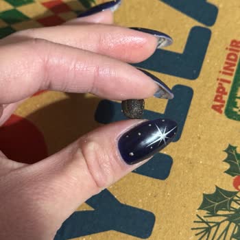 Domino's Pizza Zeytin Çekirdeği Nedeniyle Diş Kırıldı, Masrafların Telafisi Talebi