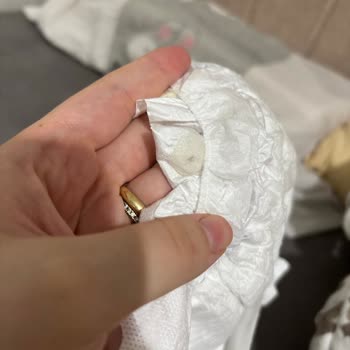 Molfix Bebek Bezinde Sert Yapışkan Bulunması Cilt Zararına Yol Açabilir