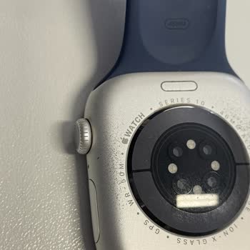 Apple Watch Serisi 10 Boya Dökülmesi Sorunu Ve Ücretsiz Değişim Talebi