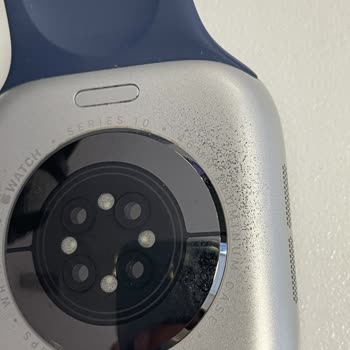 Apple Watch Serisi 10 Boya Dökülmesi Sorunu Ve Ücretsiz Değişim Talebi