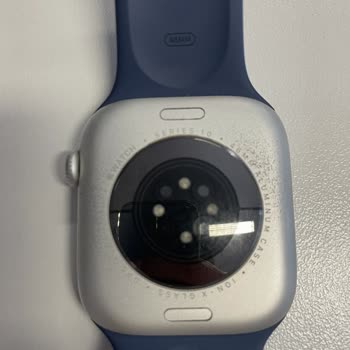 Apple Watch Serisi 10 Boya Dökülmesi Sorunu Ve Ücretsiz Değişim Talebi