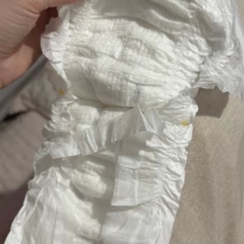 Molfix Bebek Bezlerinde Üretim Hatası Fazladan Parça Ve Güvenlik Endişesi