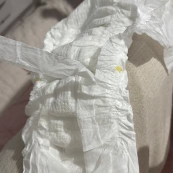 Molfix Bebek Bezlerinde Üretim Hatası Fazladan Parça Ve Güvenlik Endişesi