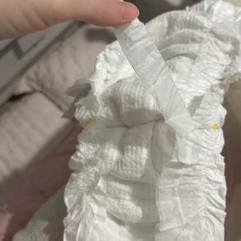 Molfix Bebek Bezlerinde Üretim Hatası Fazladan Parça Ve Güvenlik Endişesi