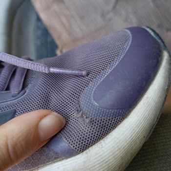 Adidas Ayakkabısı Kenardan Yırtıldı, Trendyol İade İsteğini Reddetti