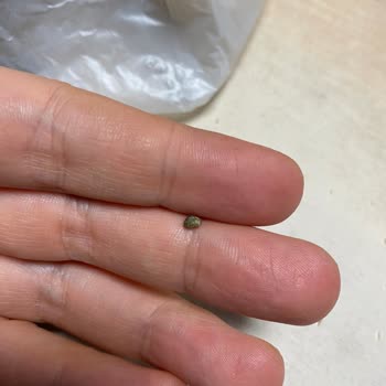 Burgerde Taş Nedeniyle Diş Kırıldı, Sağlık Riski Ve Cevapsız Müşteri Hizmetleri