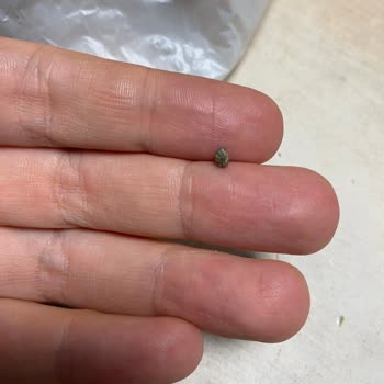 Burgerde Taş Nedeniyle Diş Kırıldı, Sağlık Riski Ve Cevapsız Müşteri Hizmetleri