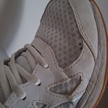 Ayakkabının Sağ Tekinde Açılma Ve Garanti Reddi