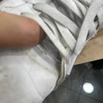 Adidas Ayakkabının Hızlı Parçalanması Ve FLO’nun Müşteri Hatası Reddi