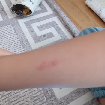 Yaşam Yolu Rehabilitasyon Merkezi Çalışan Personel Tarafından Fiziki Şiddet Uygulanması