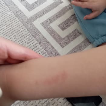 Yaşam Yolu Rehabilitasyon Merkezi Çalışan Personel Tarafından Fiziki Şiddet Uygulanması