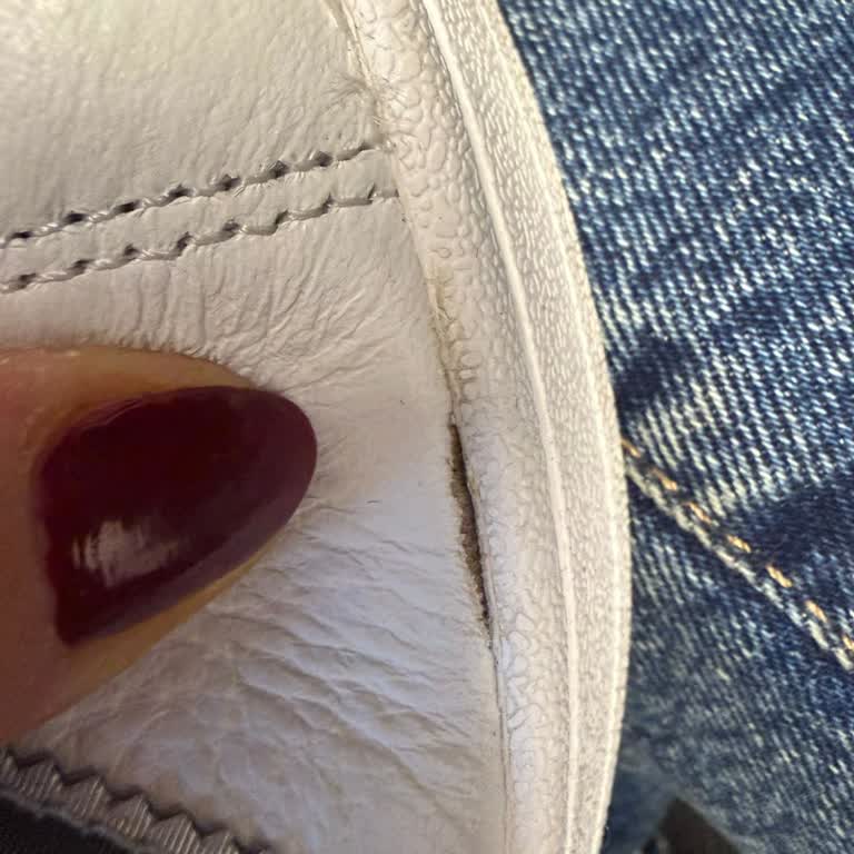 Ayıplı Adidas Superstar Ayakkabı Açıldı, İade Talebi Reddedildi