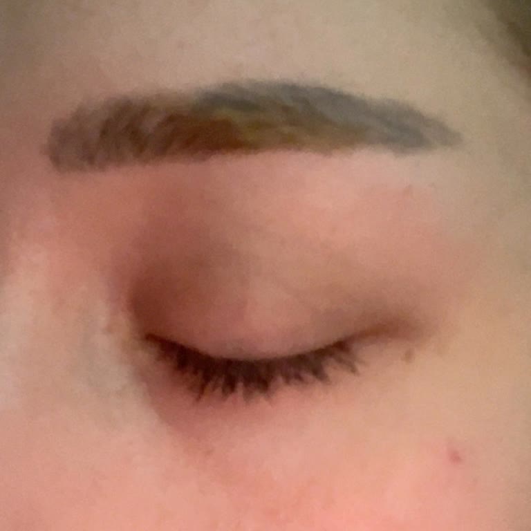 Mamak Şubesinde Kaş İşlemi Sonrası Renk Bozukluğu Ve İade Talebi