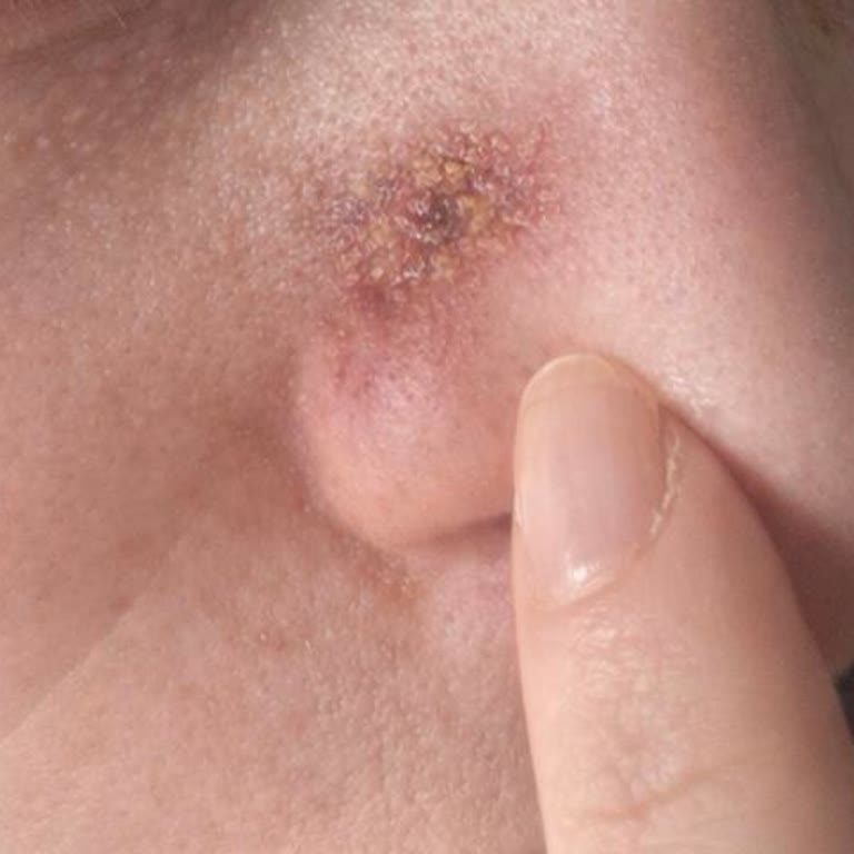 Dçy Klinik Çene Dolgusu, Botoks ve Lazer İşlemlerinden Memnun Kalmadım