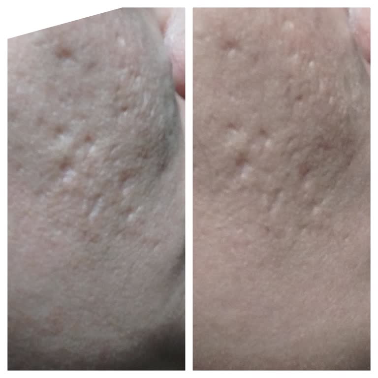 Enz Beauty Center Verilen Sözlerin Tutulmaması