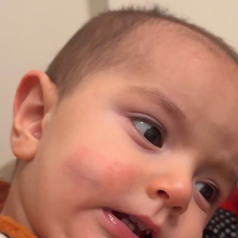 Mustela Arnica Jel'de Çocukta Kızarıklık Ve İade Talebi