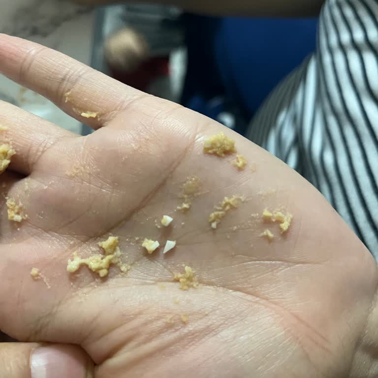 A101 Tereyağlı Bisküvi İçinde Sert Yabancı Plastik Parça Bulundu