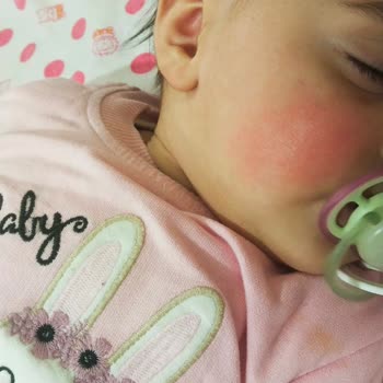 Bebekte Alerji Ve Şiddetli İshal Oluşturan Hipp Mama Üzerine Şikayet Ve İade Talebi