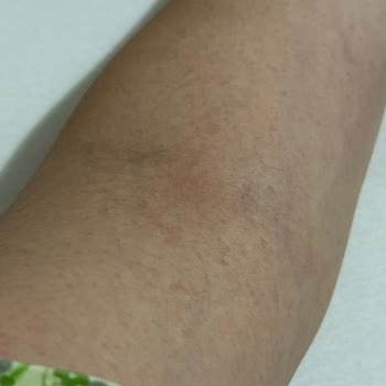 Maxi Gezi Kars Otel Yerine Erzurum Atlas Otel’e Zorla Değiştirilen Konaklama Ve Reddedilen Çözüm