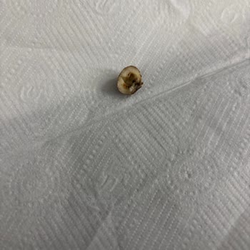 Bozuk Karışık Kuruyemiş Ürünü İçin Değişim Talebi