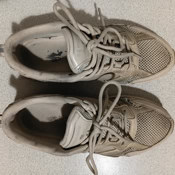 Başparmak Yırtılması Nedeniyle Değişim Ve İade Talebi