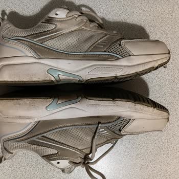 Başparmak Yırtılması Nedeniyle Değişim Ve İade Talebi