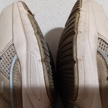 Başparmak Yırtılması Nedeniyle Değişim Ve İade Talebi