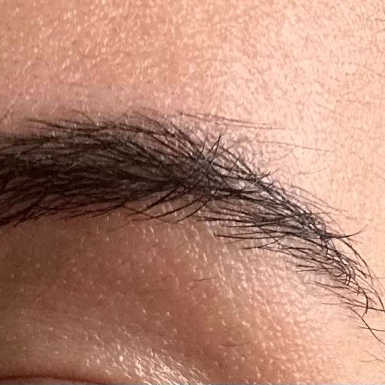 Suzan Yılmaz Beauty Salon Kaş Silme İşleminde Sonuçsuzluk Gizli Ek Ücret ve İade Talebi