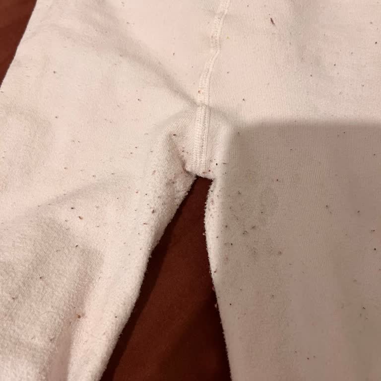 İlk Haftada Tüylenen Termal Çorapta Ayıplı Ürün Şikayeti