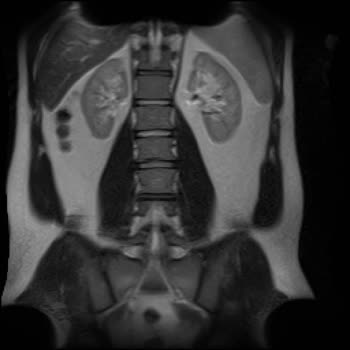 Türkiye Sigorta’nın Provizyon Reddi Ve Tedavi Gecikmesi!