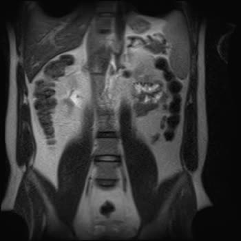 Türkiye Sigorta’nın Provizyon Reddi Ve Tedavi Gecikmesi!