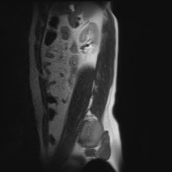 Türkiye Sigorta’nın Provizyon Reddi Ve Tedavi Gecikmesi!