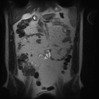 Türkiye Sigorta’nın Provizyon Reddi Ve Tedavi Gecikmesi!