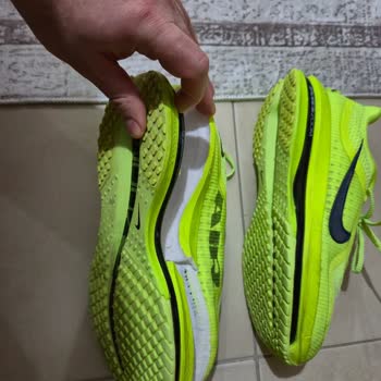 Ayıplı Ayakkabının Tabanı 3 Kullanımda Yırtıldı, Satıcı Kullanıcı Hatası Dedi