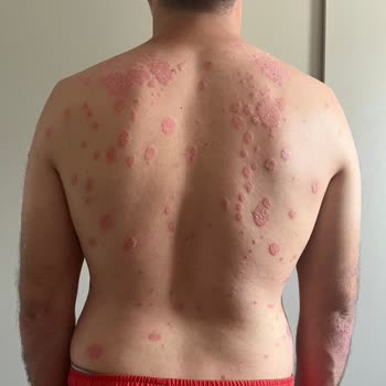 Dr. Mehmet İlteber Bahadır İlk Muayenede Yüzeysel Değerlendirme!