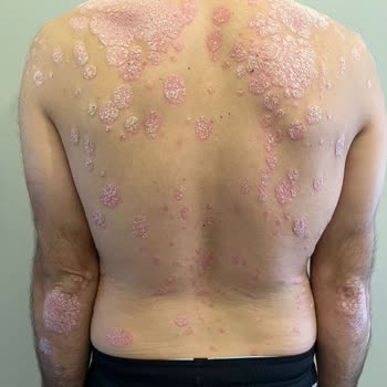 Dr. Mehmet İlteber Bahadır İlk Muayenede Yüzeysel Değerlendirme!