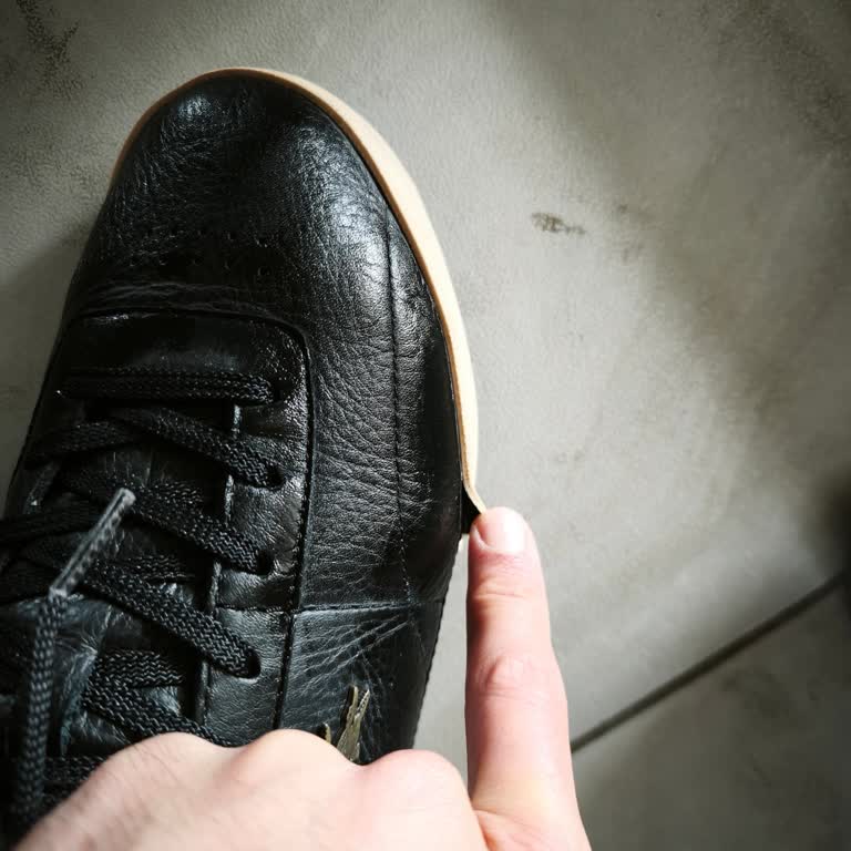 Lacoste Ayakkabısında Açılma Sorunu Ve Yardım Bulamama