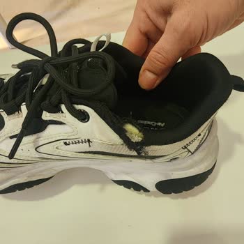 Skechers Ayakkabısında Kısa Sürede Belirgin Yırtılmalar Ve Üretim Sorumluluğu Reddi